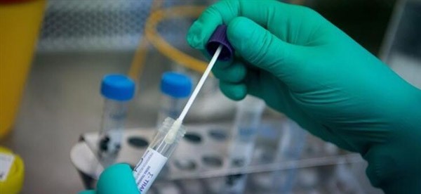 KPSS için PCR sonucu istenecek