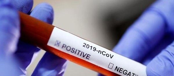KKTC’de 102’si yerel 132 pozitif vakaya rastlandı