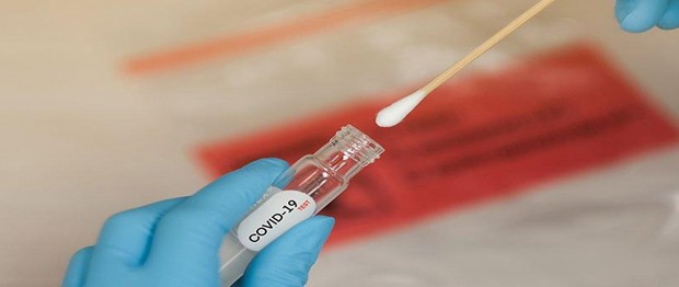 Bayram boyunca antijen test yerleri açıklandı