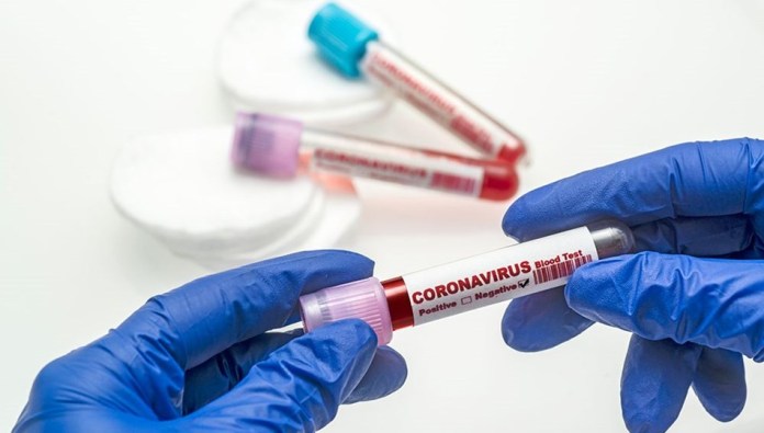Kalbine yenik düşen hastanın Covid-19 test sonucu pozitif çıktı!