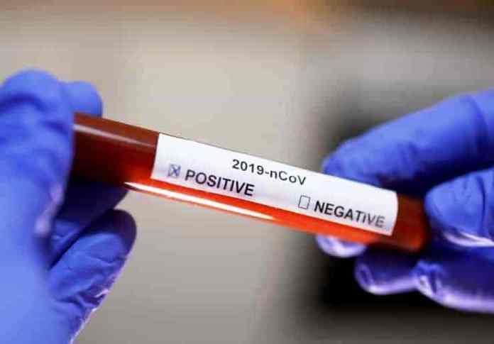 İçişleri Bakanlığı: İki personelin PCR test sonucu pozitif çıktı