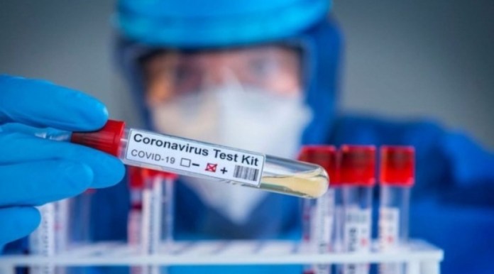 Laboratuvarlarda yeniden PCR ve antijen yapılacak