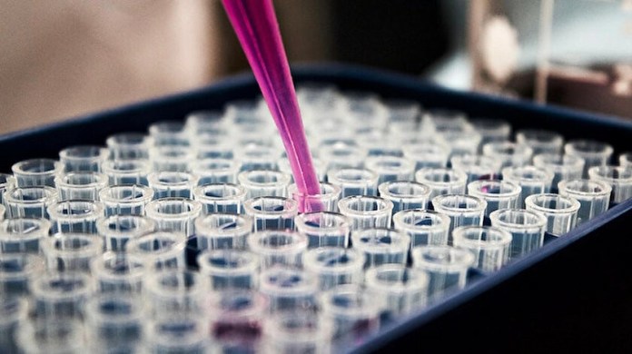 Türkiye’de 20 bin 33 kişinin testi pozitif çıktı, 278 kişi hayatını kaybetti