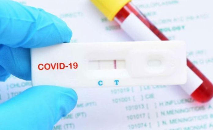 Sahte test ibraz ederek KKTC’ye geçmek istediler