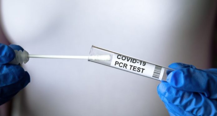 KKTC’de 111’i yerel 137 pozitif vakaya rastlandı,3 kişi hayatını kaybetti